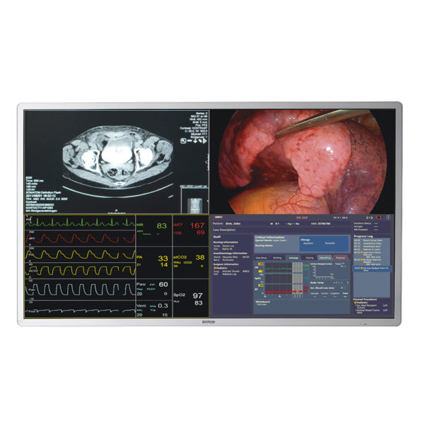 OpenOR OverIP compatible displays